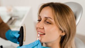 How Long Do Veneers Last and When to Replace Them