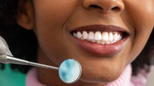 Professional Teeth Cleaning: What You Should Know Before Your Visit