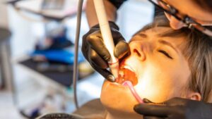 Tooth Colored Fillings: What Makes Them a Trusted Fix