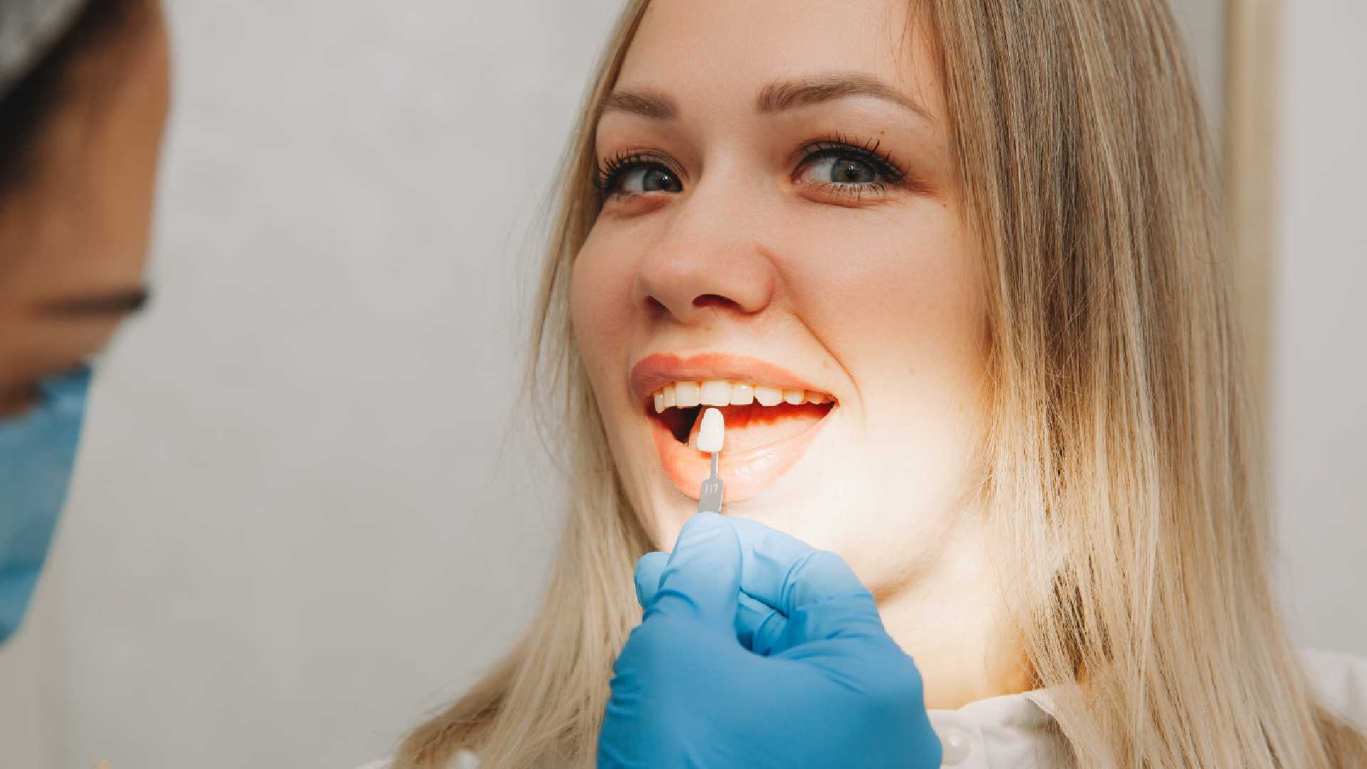 What You Need to Know About Cosmetic Dental Bonding Today